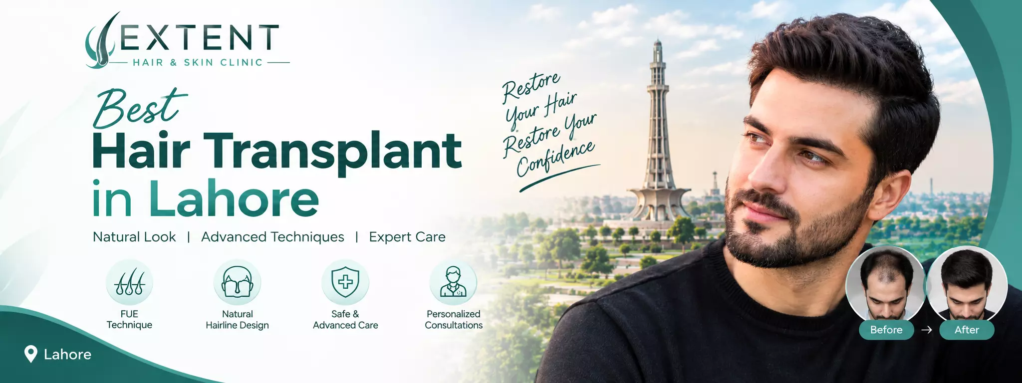 Best Hair Transplant in Lahore A Complete Guide to Natural-Looking Hair Restoration