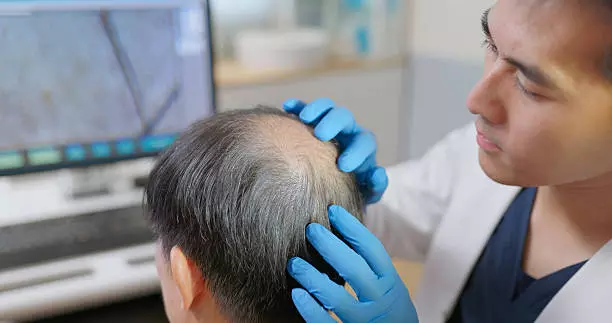 Can FUT Hair Transplant in Dubai Be Combined With FUE Later?