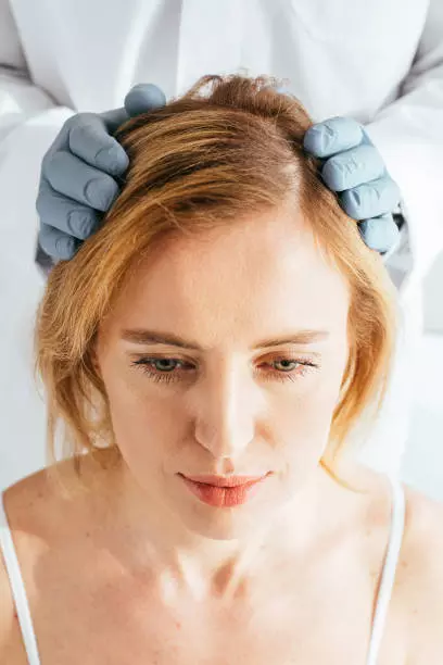 Frontline Hair Fixing in Dubai: Improve the Appearance of Thinning Temples
