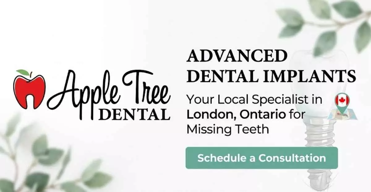 Tooth Implant London: Advanced Dental Implants London Ontario for Missing Teeth
