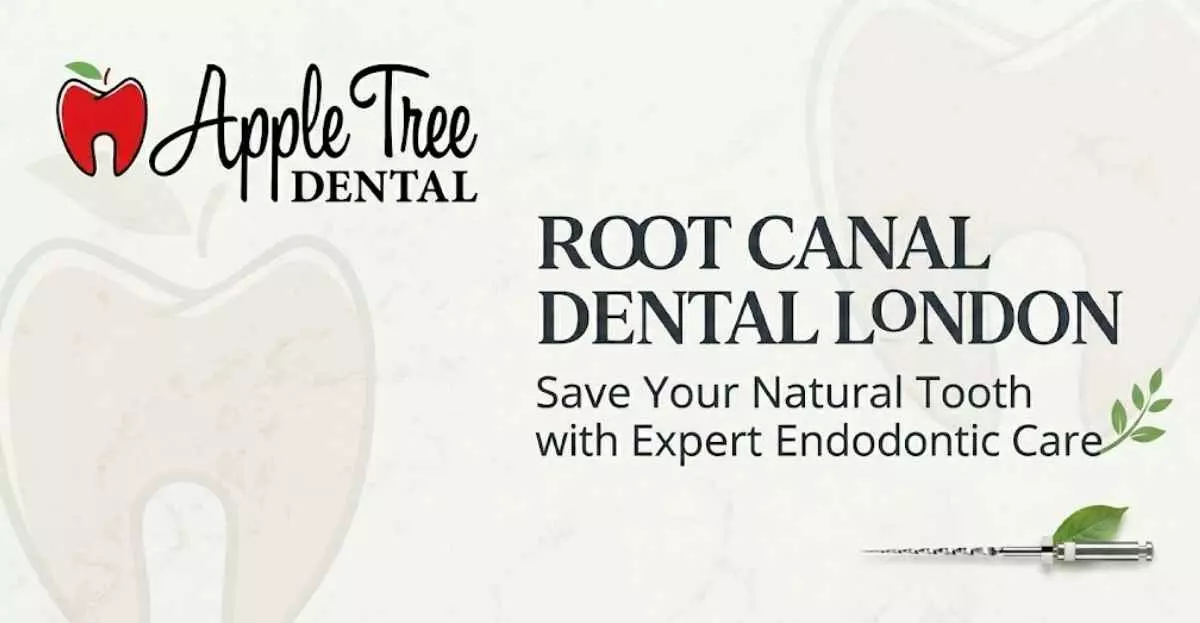 Root Canal Treatment in London: How It Works and When You Might Need It