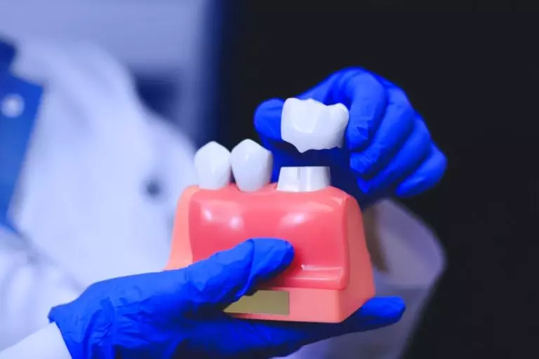 Dental Implants Whole Mouth: A Complete Smile Transformation with Berkeley Lake Dental