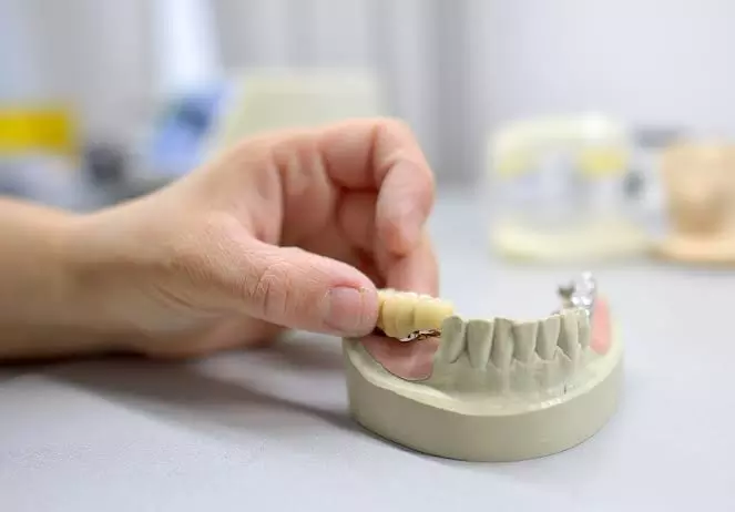 Signs You May Need A Dental Bridge For Missing Teeth