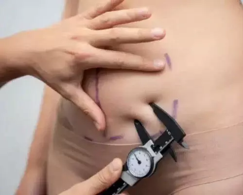 How long does tummy tuck surgery take?