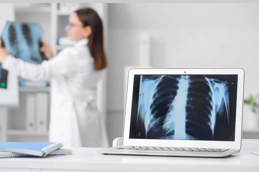 Specialized Respiratory Care for Long-Term Lung Health
