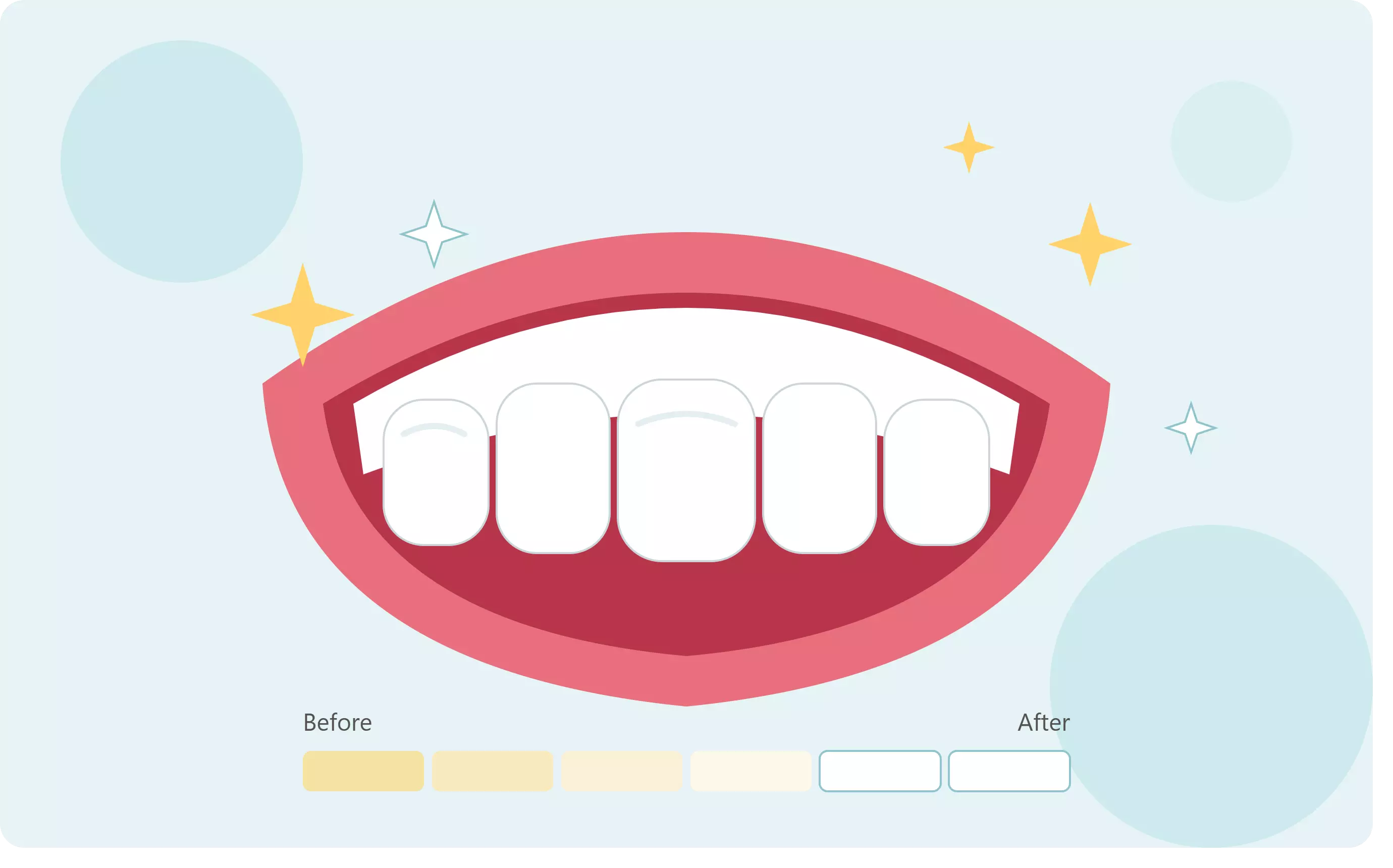 Dental Implants: A Modern Solution for Missing Teeth