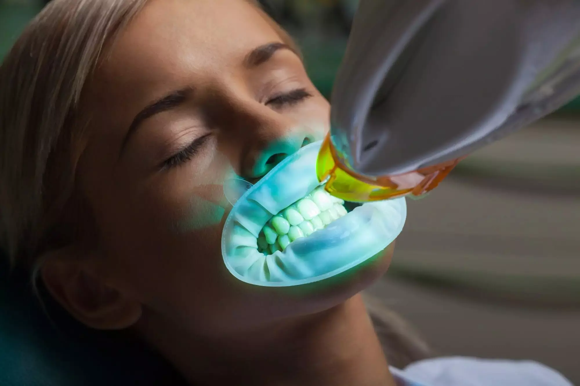 Painless Root Canal Treatment | La Mirada Dentist Expert