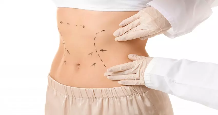 Tummy Tuck in Dubai: Cost Breakdown and Financing Options