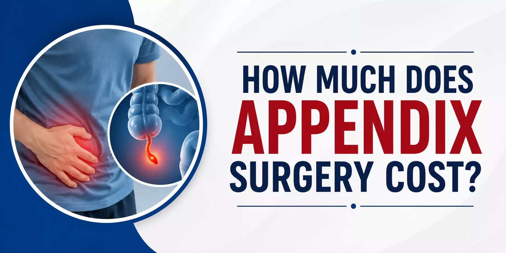 How Much Does Appendix Surgery Cost? A Complete Guide