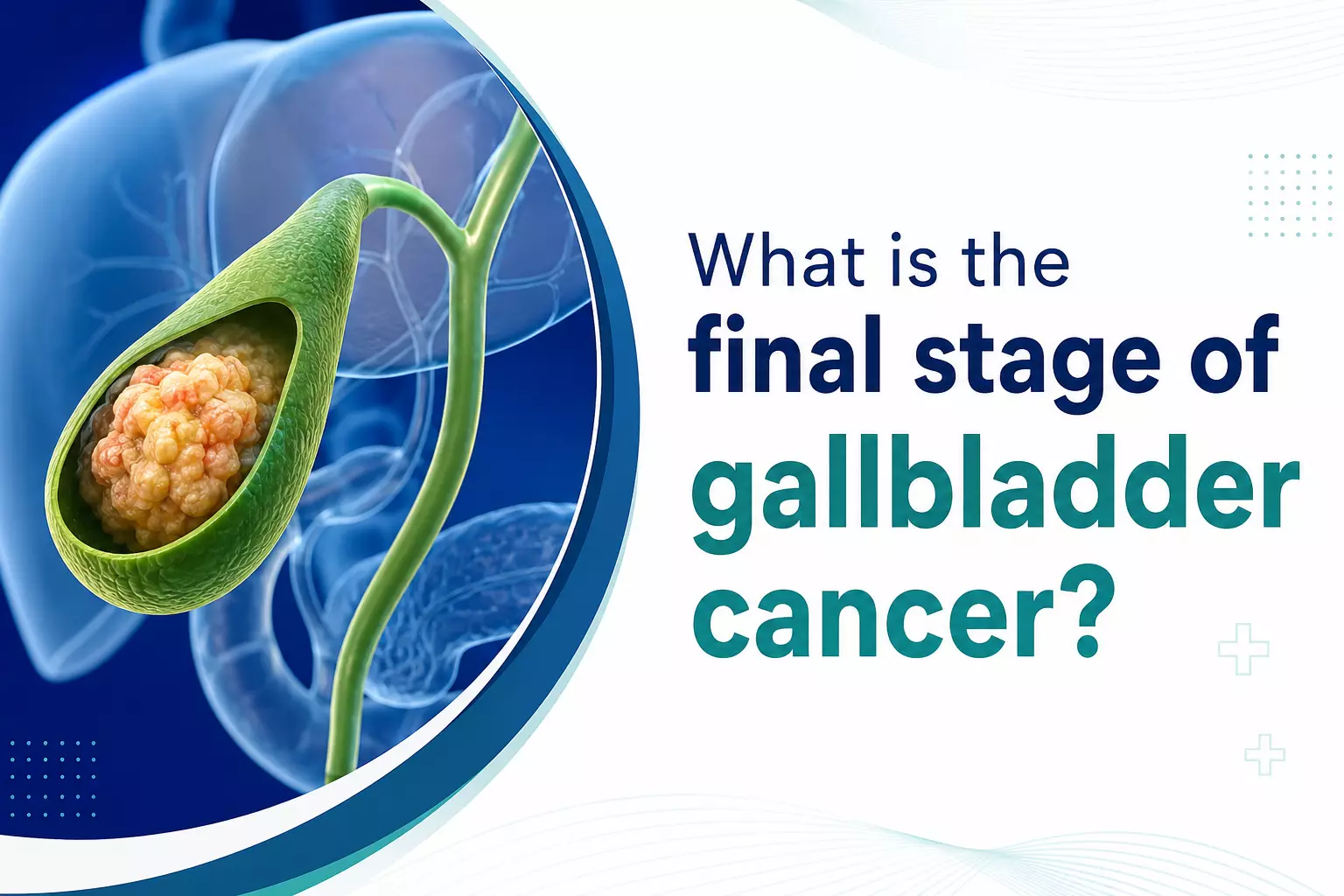 What is the Final Stage of Gallbladder Cancer?