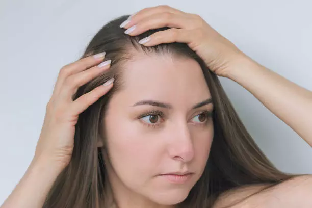 Nutrafol Hair Growth – Physician Formulated Supplement for Thicker, Fuller & Stronger Hair
