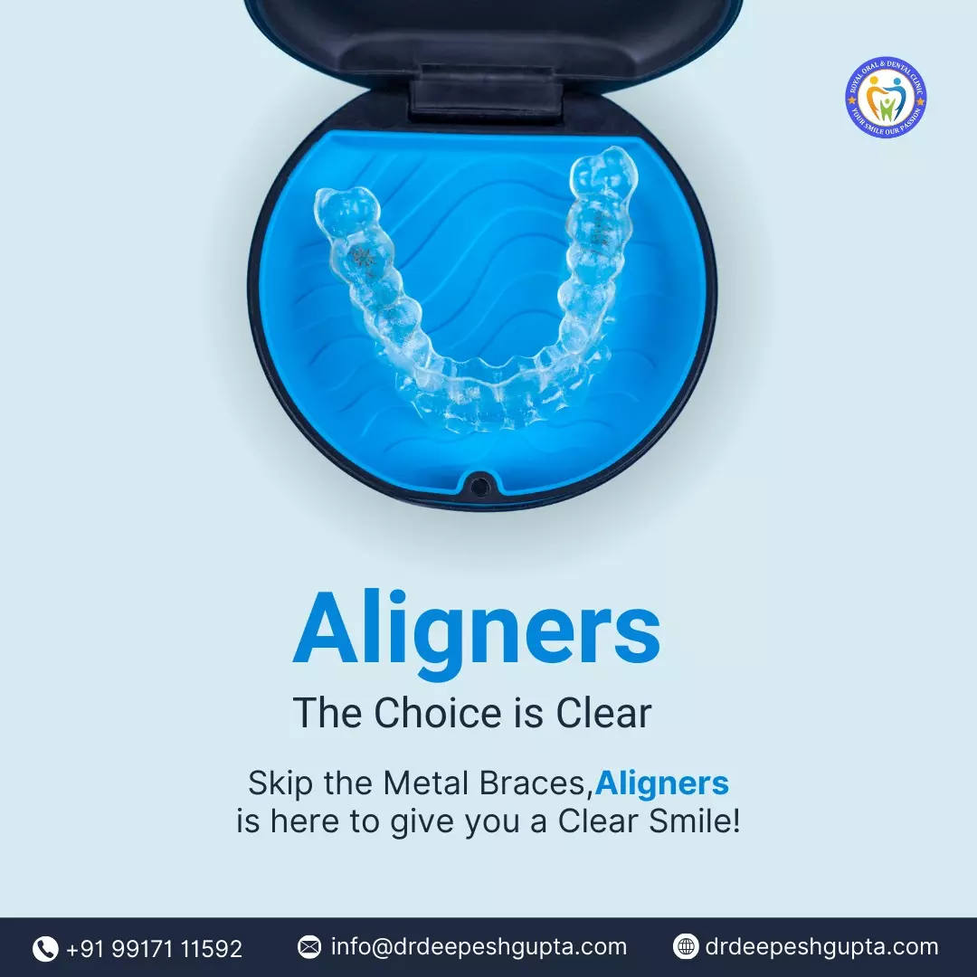 Cosmetic Dentistry: Transforming Smiles and Boosting Confidence at Royal Oral & Dental Clinic