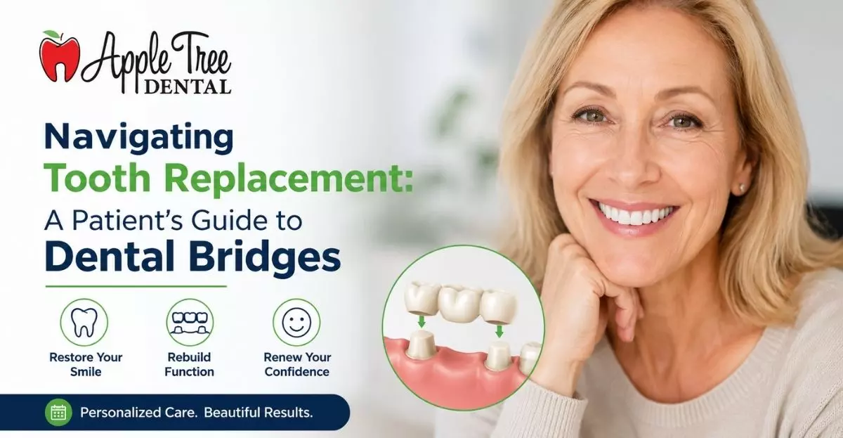 Navigating Tooth Replacement: A Patient’s Guide to Dental Bridges