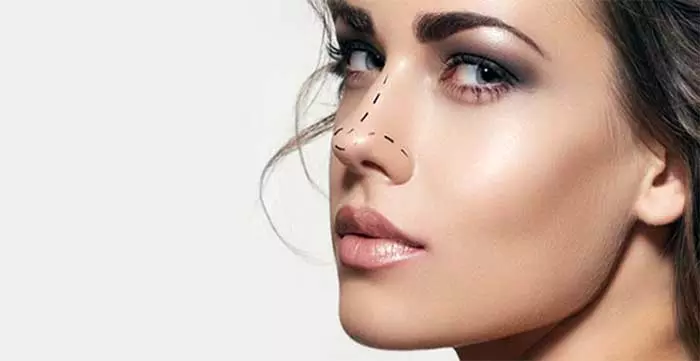 Comparing Rhinoplasty Providers in Islamabad: What Should You Look For?