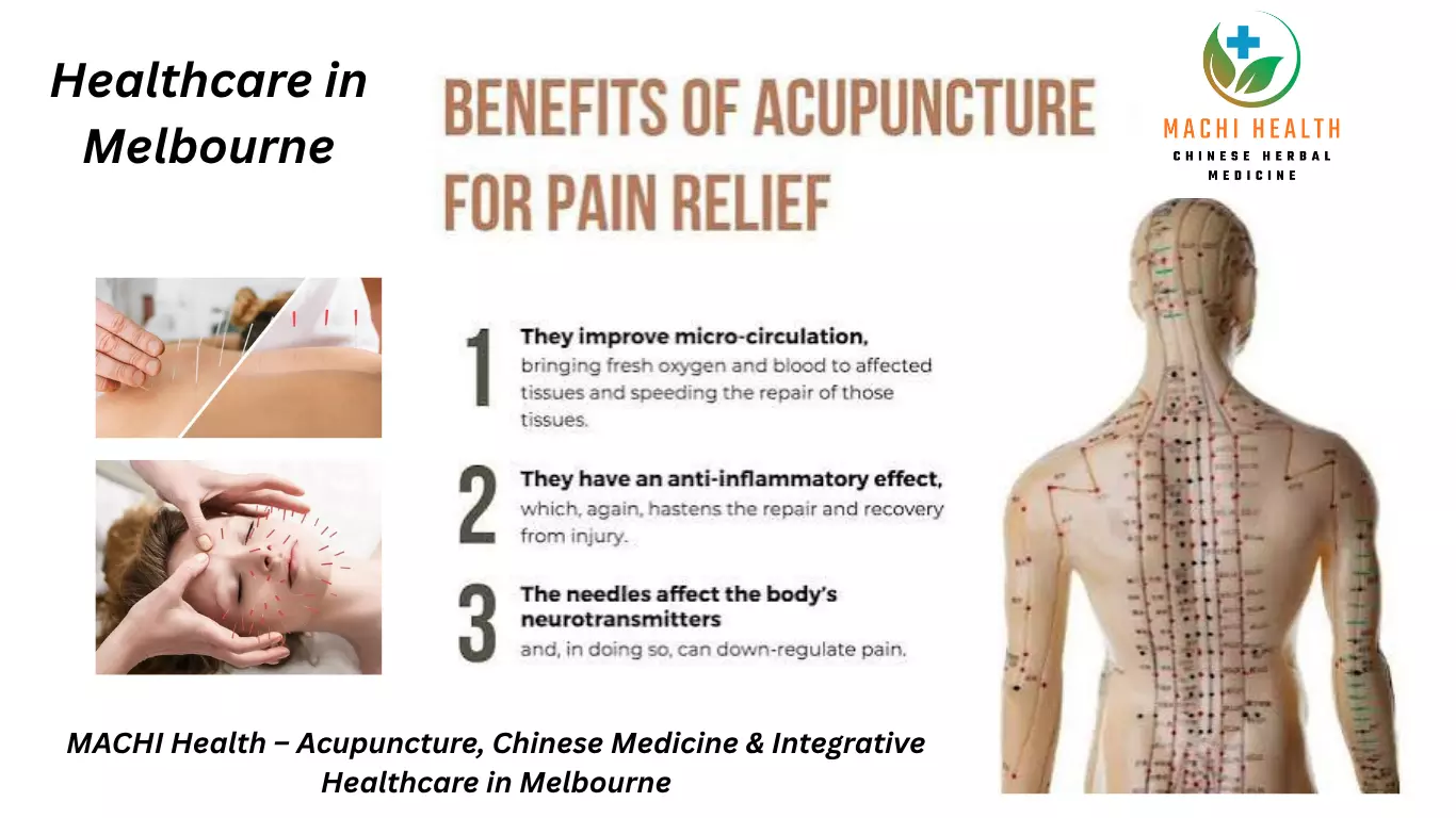 Acupuncture Melbourne: A Practical Guide to Treatment, Costs and Benefits
