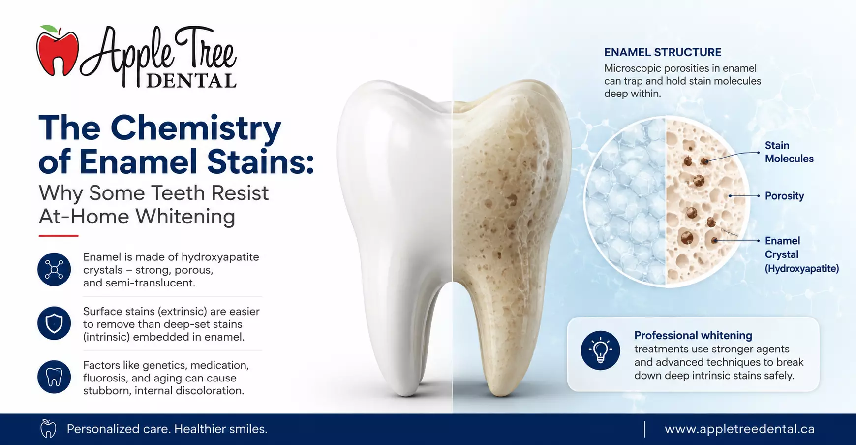The Chemistry of Enamel Stains: Why Some Teeth Resist At-Home Whitening