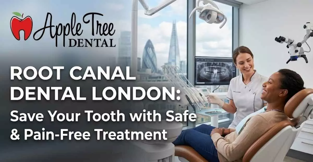Root Canal Dental London: Save Your Tooth with Safe & Pain-Free Treatment