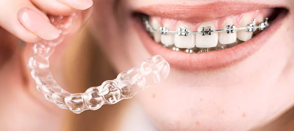 Orthodontist Ancaster: Complete Guide to Braces and Clear Aligners