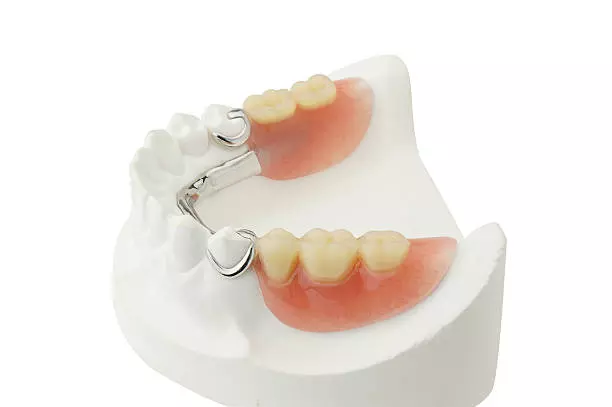 A Comfortable Way to Replace Missing Teeth Dentures in Islamabad: