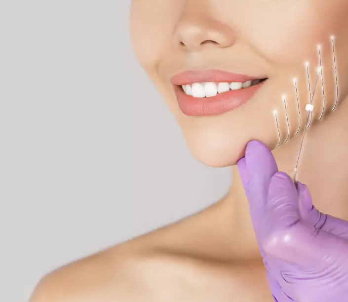 Cosmetic Thread Lift Islamabad: Patient Testimonials