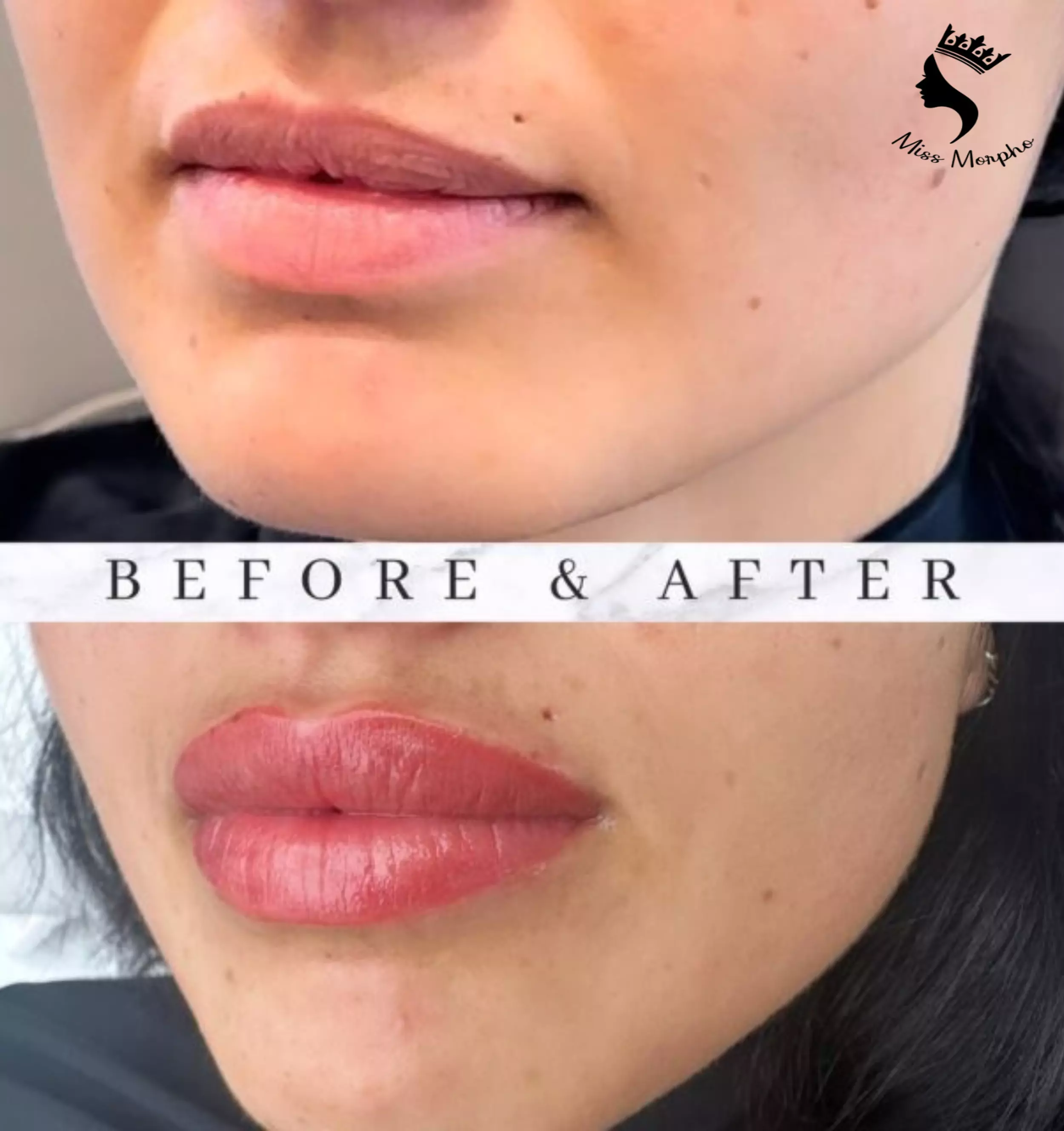 Your Best Skin A Guide to Richmond's Premier Skin Clinics