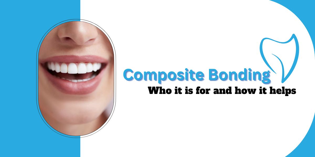 Composite bonding – who it is for and how it helps