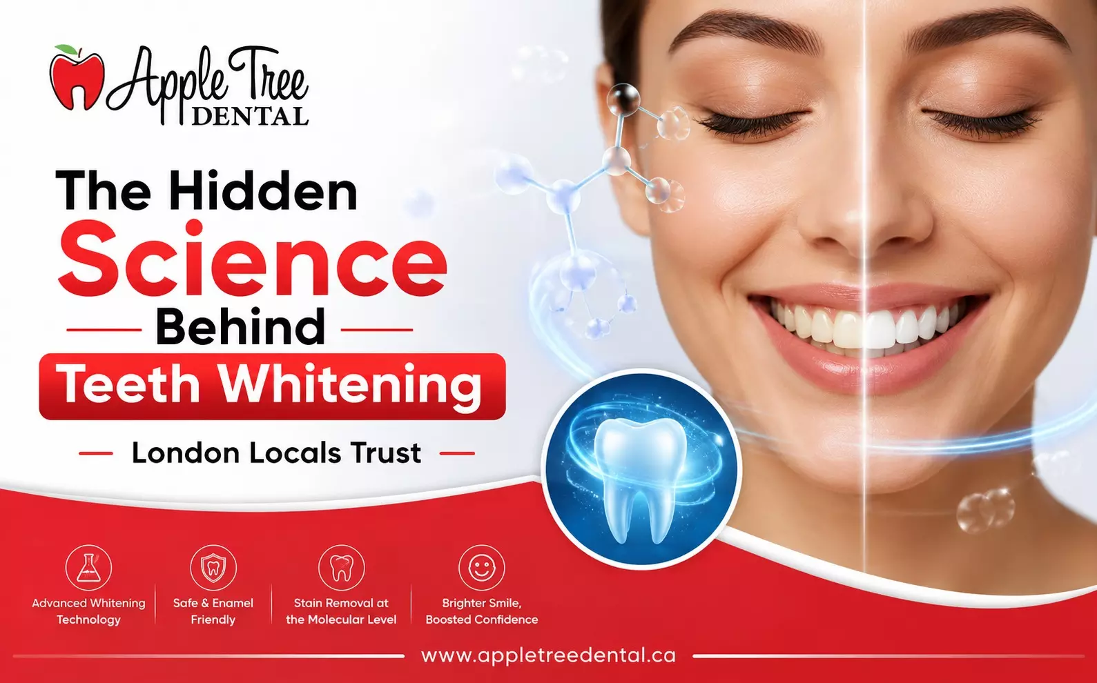 The Hidden Science Behind Teeth Whitening London Locals Trust