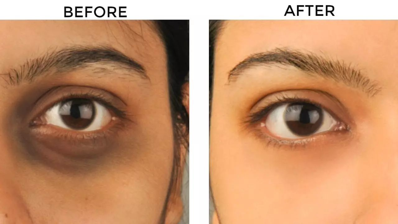 Top Clinics Offering PRP for Under-Eye Treatment in Islamabad