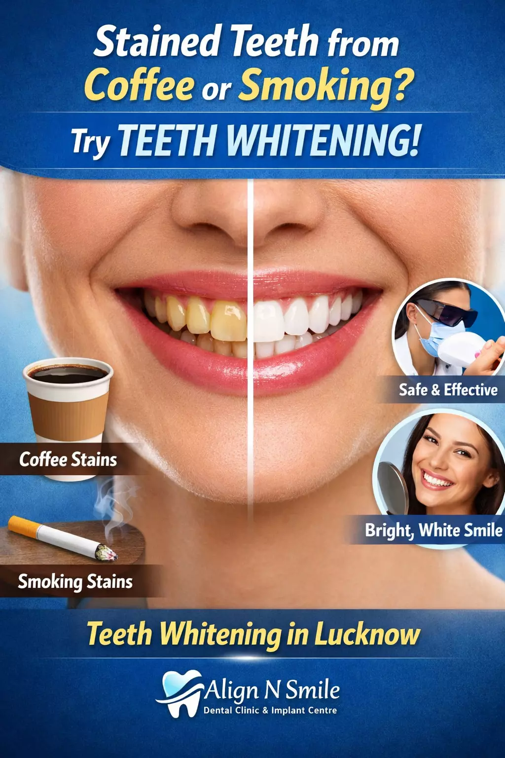 Stained Teeth from Coffee or Smoking? Try Teeth Whitening