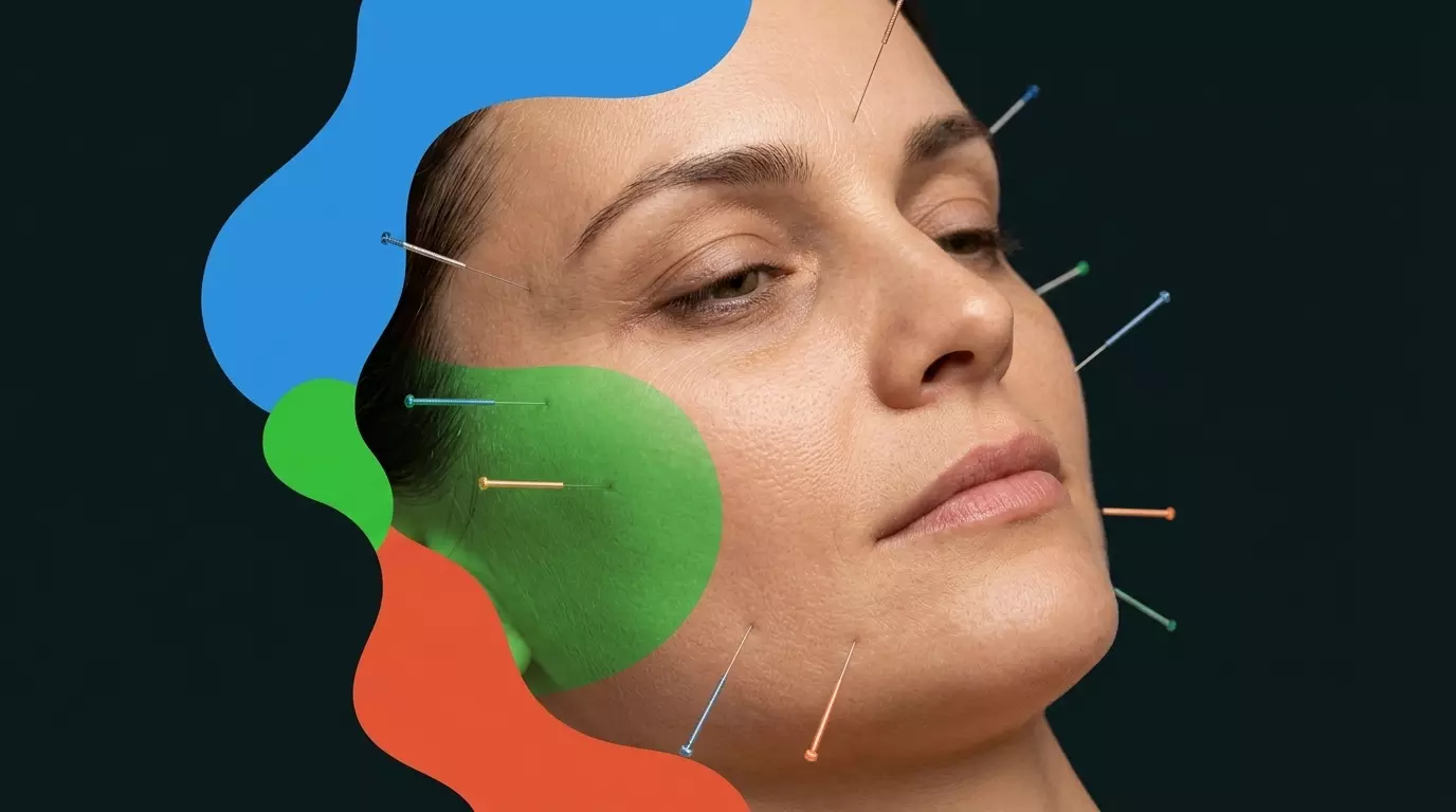 Acupuncture and Fertility: What You Should Know