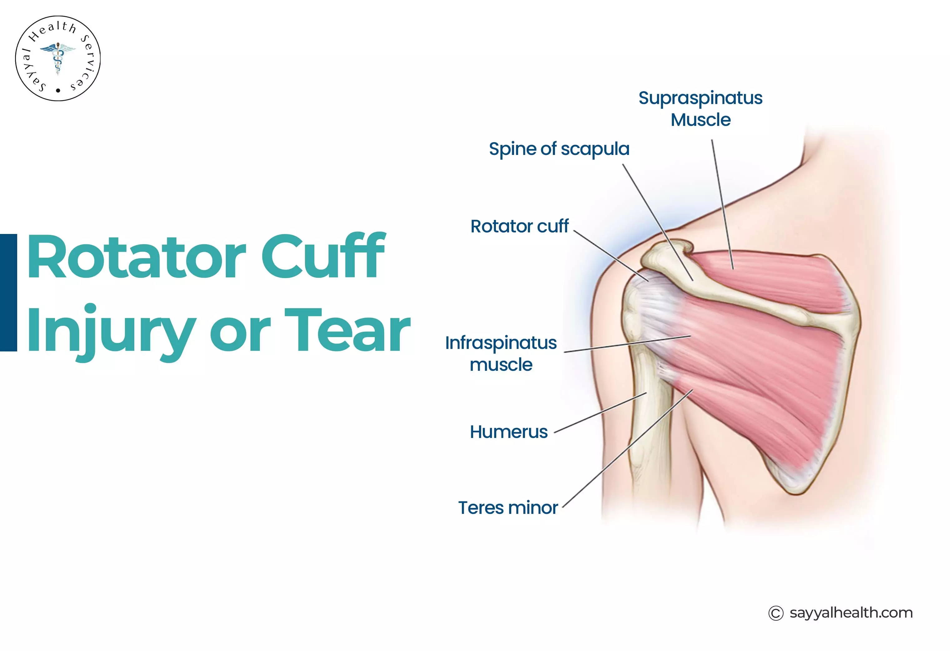 PRP Therapy for Rotator Cuff Injuries