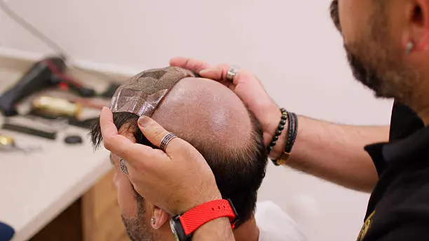 Quick, Natural & Hassle-Free Hair Solution Hair Wigs in Islamabad: