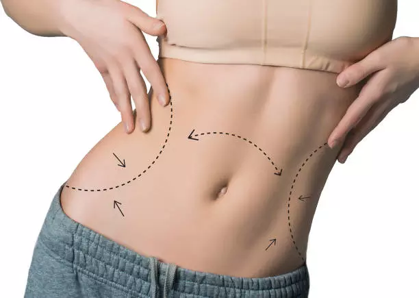 BodyTite for Thighs and Legs in Dubai: Sculpt and Smooth Without Surgery