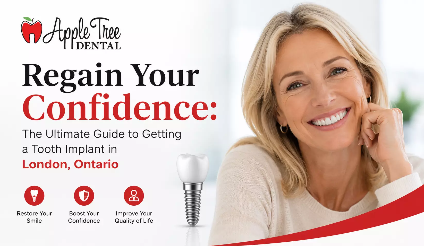 Regain Your Confidence: The Ultimate Guide to Getting a Tooth Implant in London, Ontario