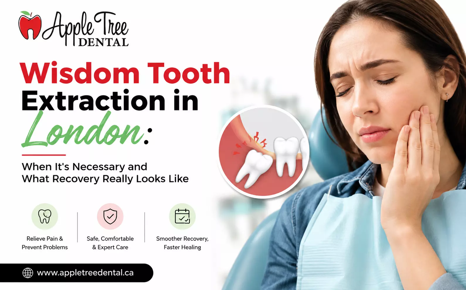 Wisdom Tooth Extraction in London: When It's Necessary and What Recovery Really Looks Like