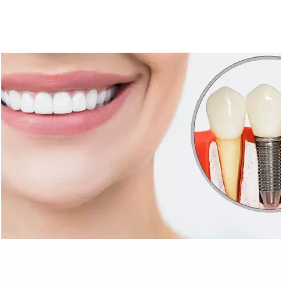 Experience Gentle Care at a Top Dental Office in LA
