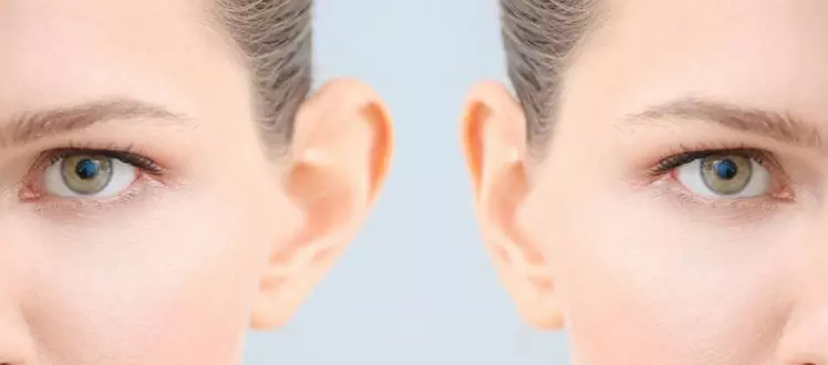 Tips for Quick Recovery After Ear Correction Surgery in Islamabad