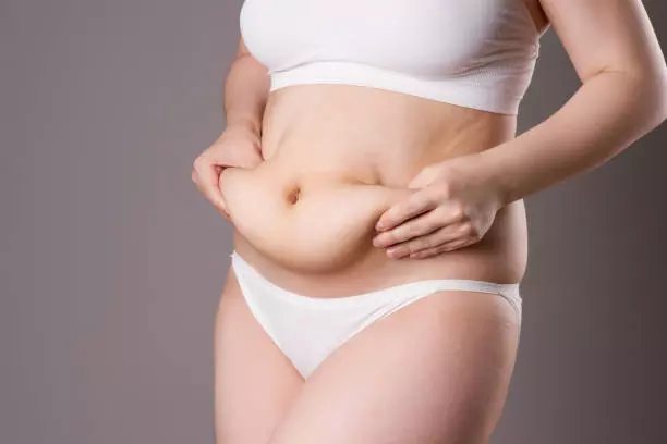Tummy Tuck Recovery in Dubai: What to Expect Week by Week