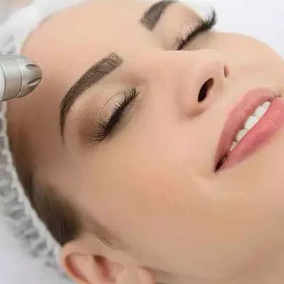 Does Laser Treatment Require Maintenance Sessions Forever?