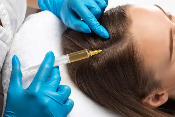 How many PRP Hair Treatment sessions are needed