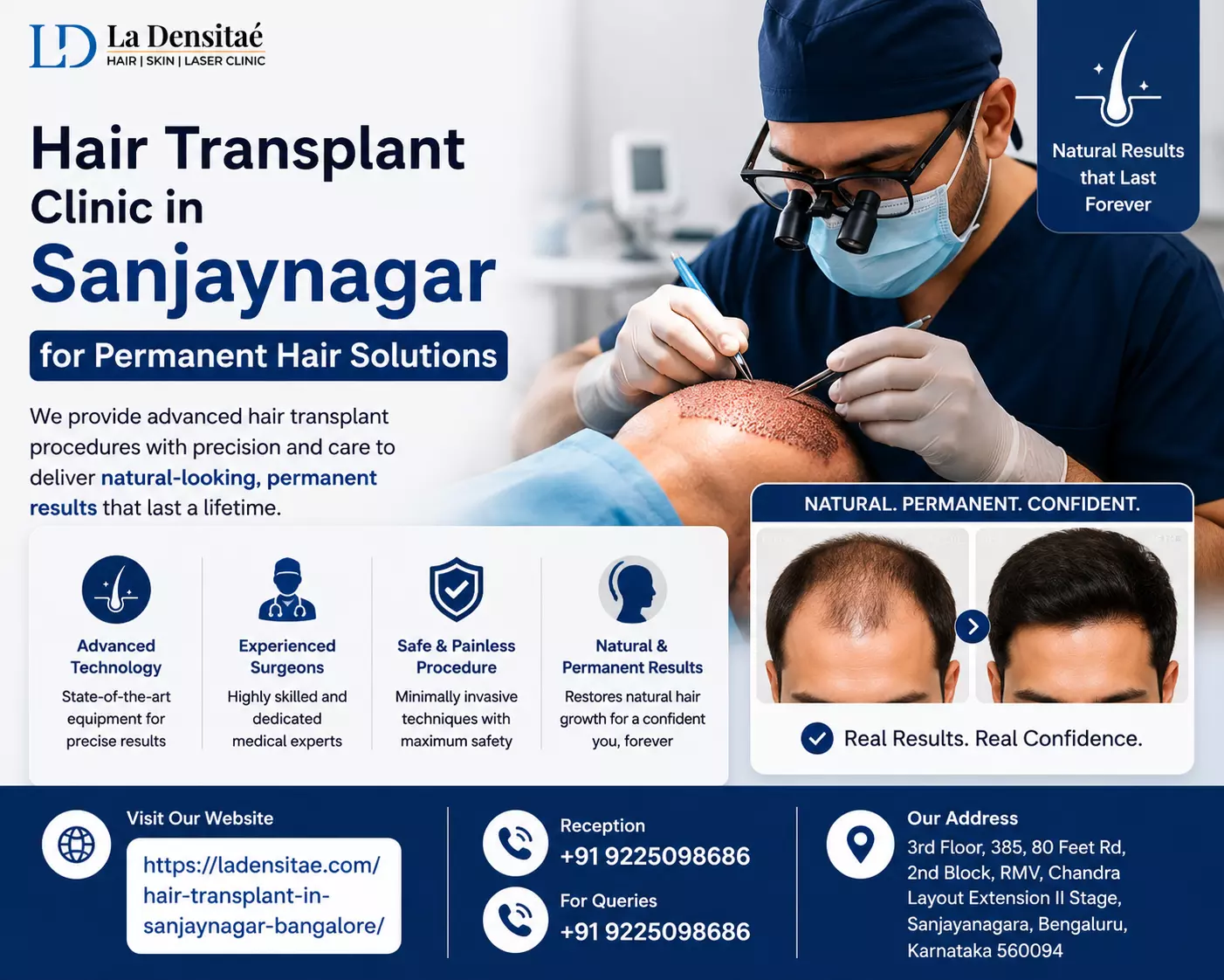 Hair Transplant Clinic in Sanjaynagar for Permanent Hair Solutions