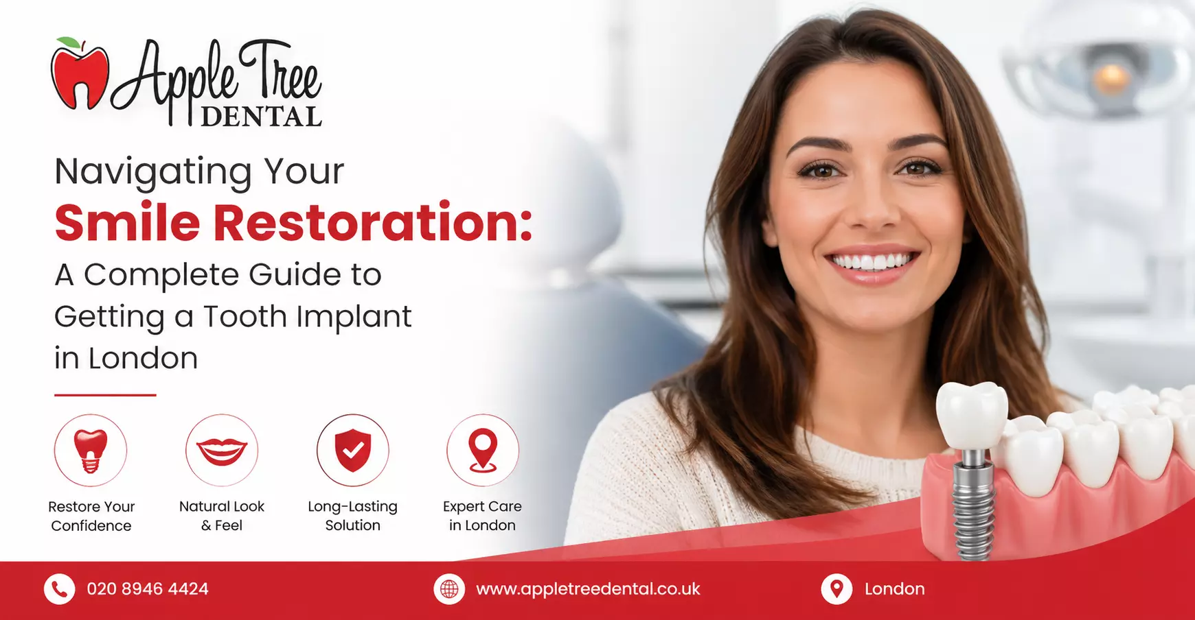 Navigating Your Smile Restoration: A Complete Guide to Getting a Tooth Implant in London