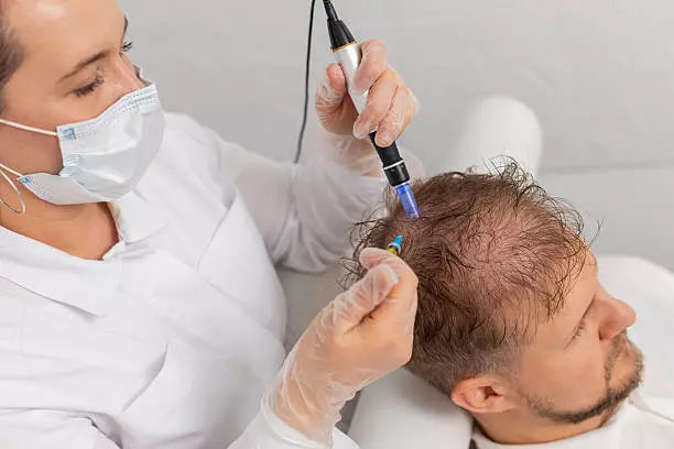 Next-Gen Hair Revival: Exosome Hair Therapy in Islamabad