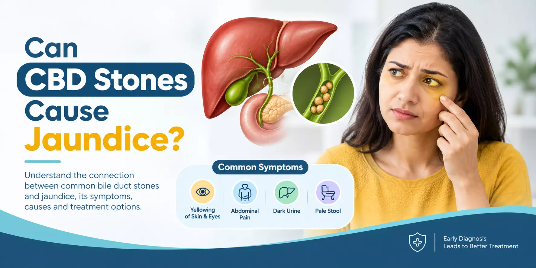 Can CBD Stones Cause Jaundice?