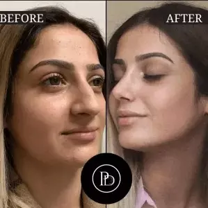 My Before & After with the Best Aesthetic Clinic in Dubai