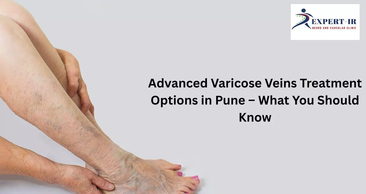 Varicocele Surgery Cost in Pune: Treatment Options and What to Expect