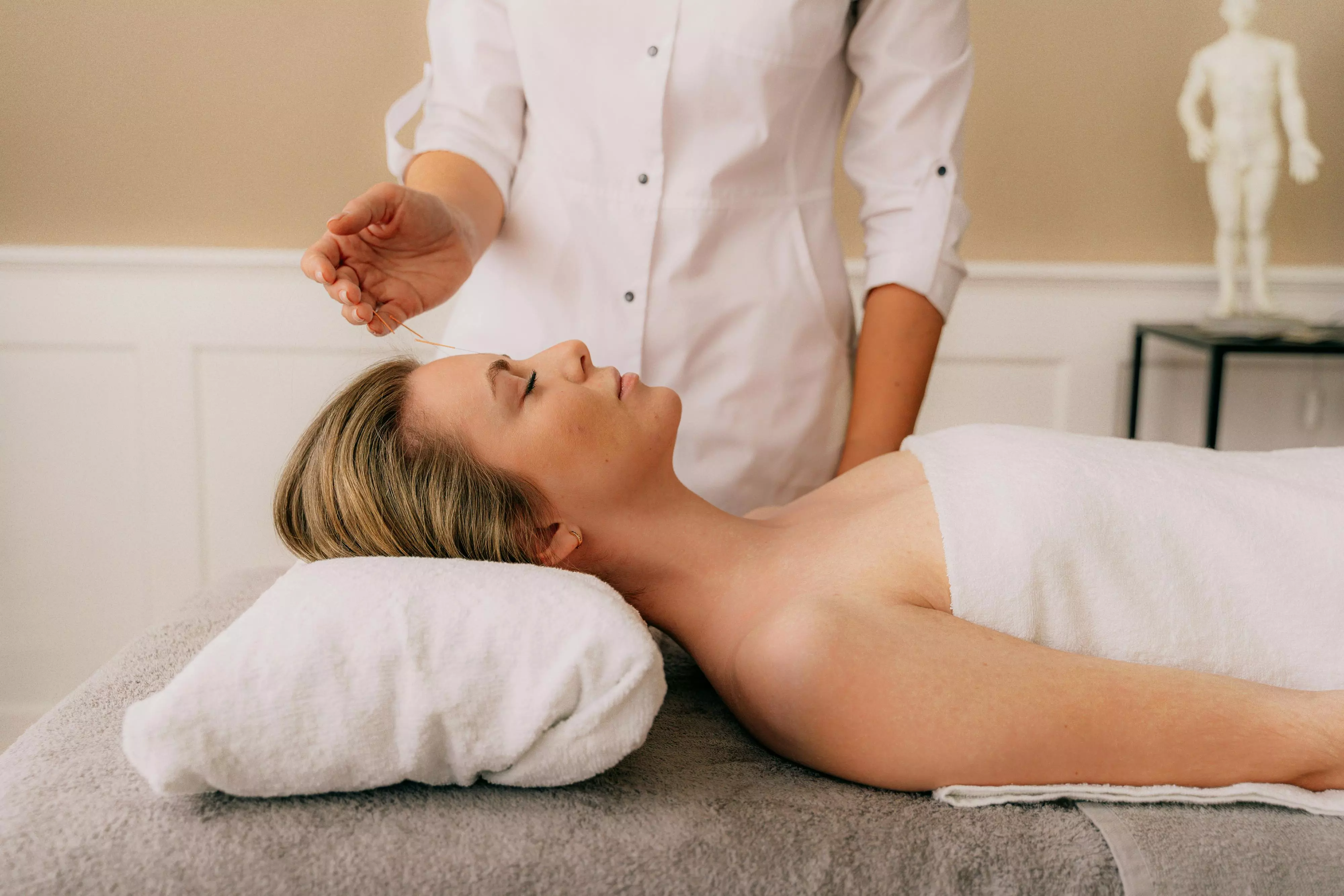 How Cosmetic Acupuncture Reduces Wrinkles
