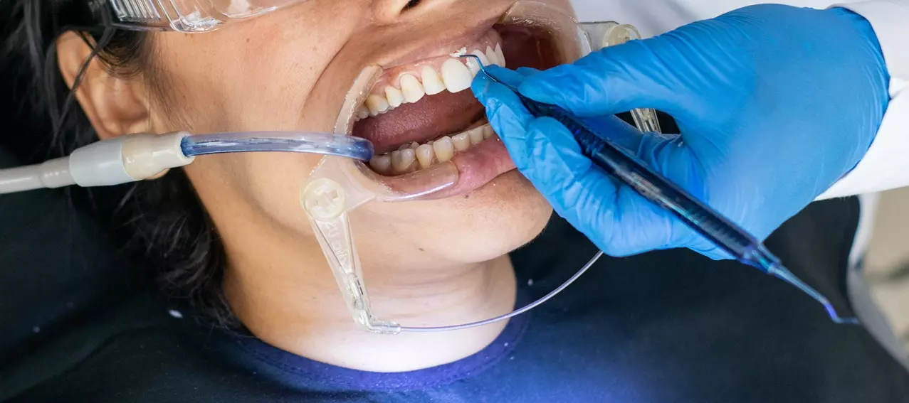 How Can Full Mouth Reconstruction Transform Your Smile and Confidence?