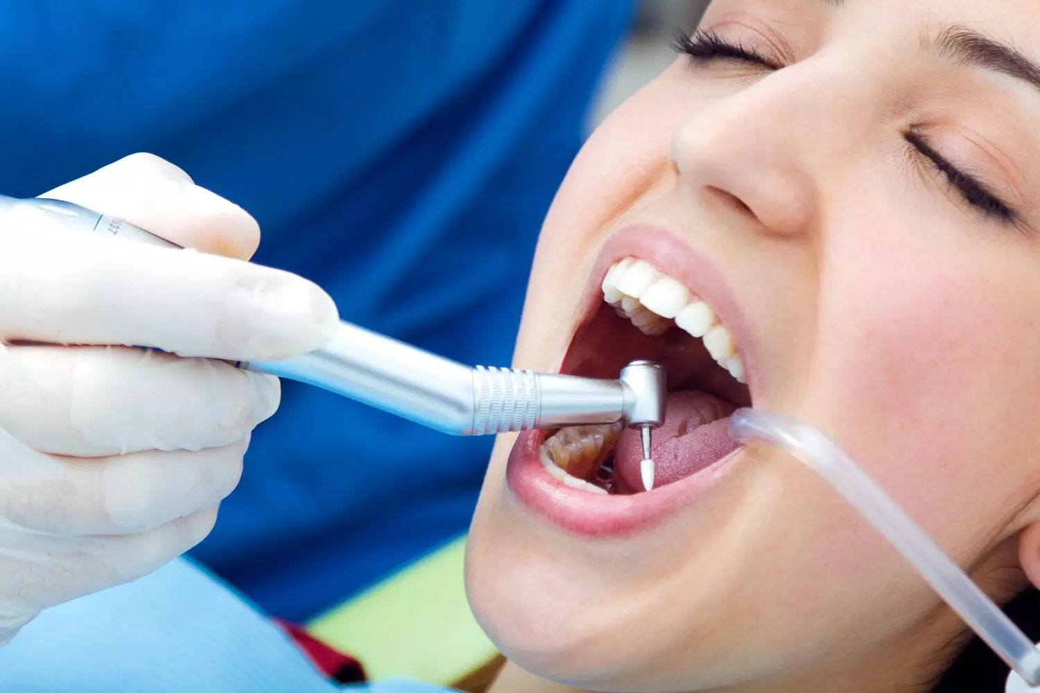 Smile Brighter for Less: $99 Teeth Cleaning Near Me