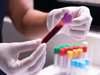 Hepatitis D Test in Routine Health Checkups: Is It Necessary?